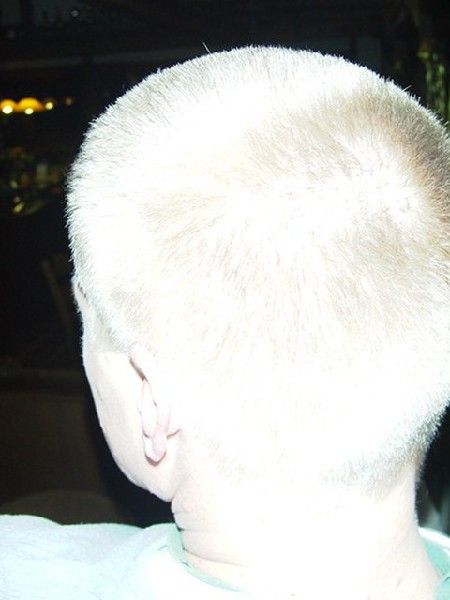 Bild_25