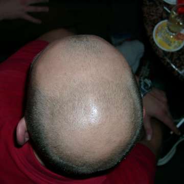 Bild_20